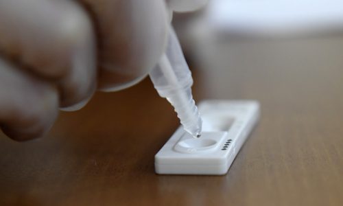 Újabb 340 ezer antigén gyorstesztet kapnak a háziorvosok